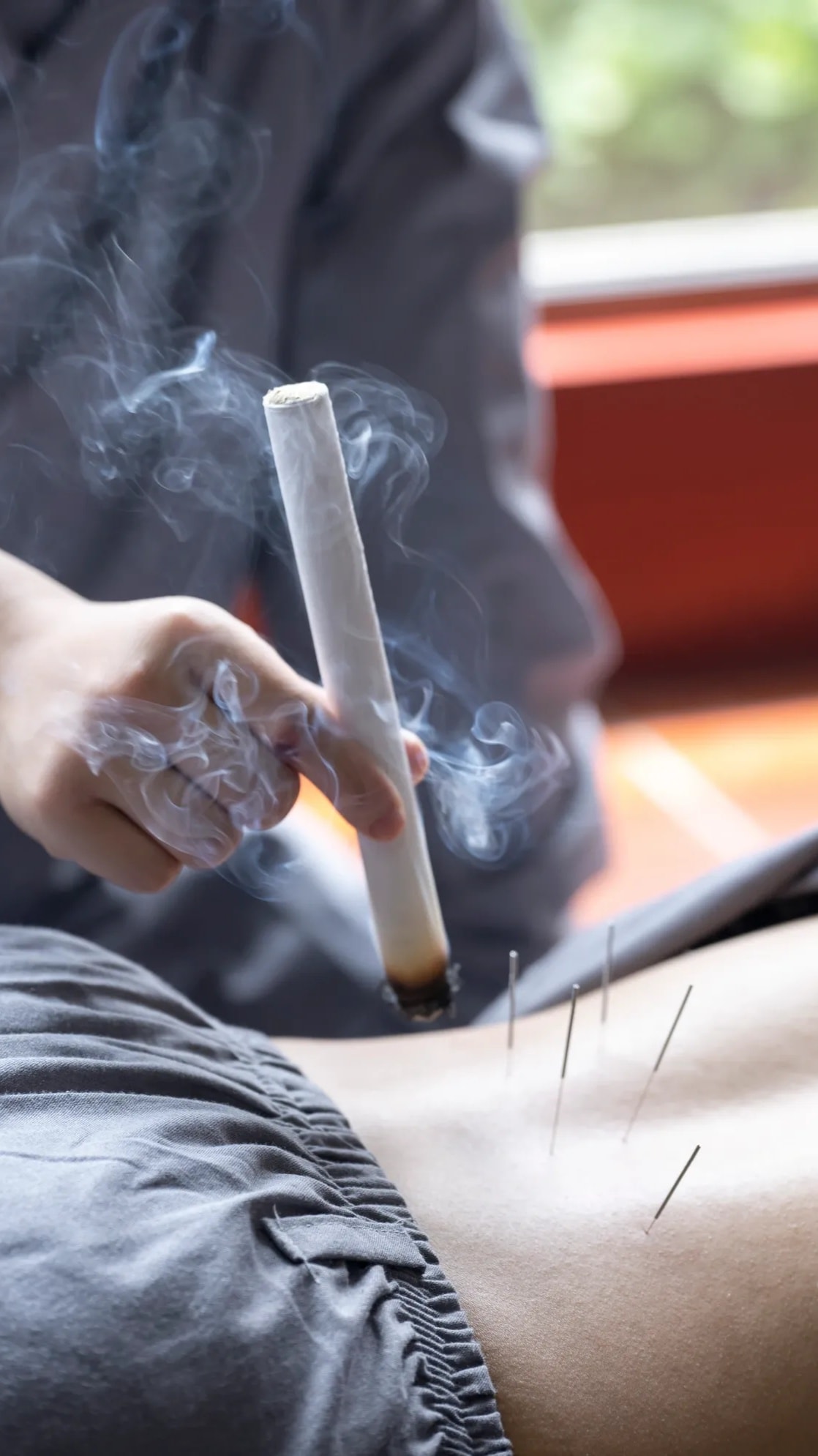 Moxibustion treatment at San Diego Healing Arts